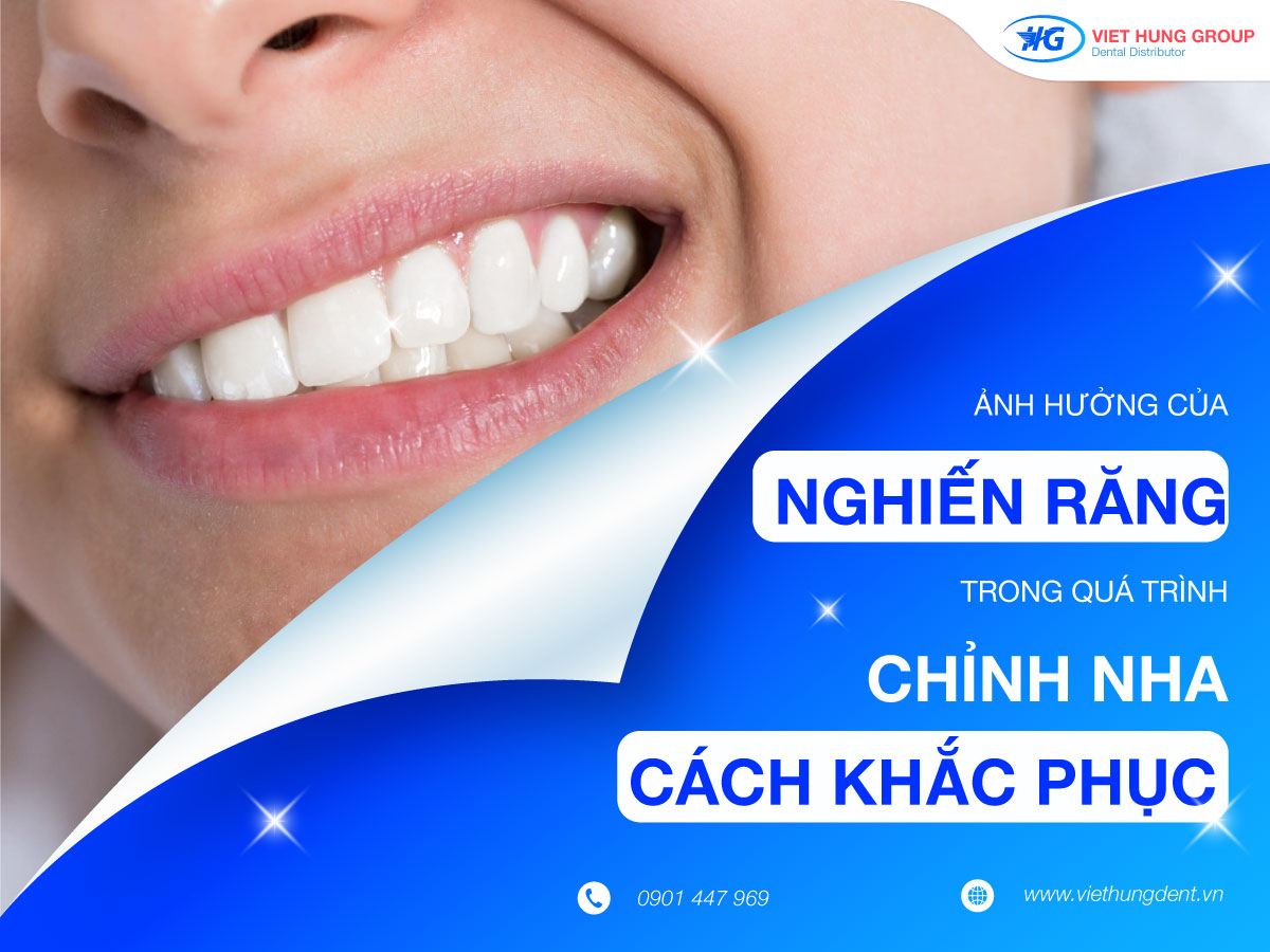 Ảnh-hưởng-của-nghiến-răng-trong-quá-trình-chỉnh-nha-và-cách-khắc-phục