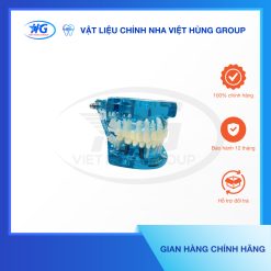 Mẫu hàm Implant