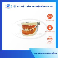 Mẫu hàm Implant