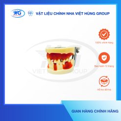 Mẫu hàm Implant