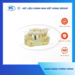 Mẫu Hàm Implant