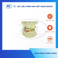 Mẫu Hàm Chỉnh Nha