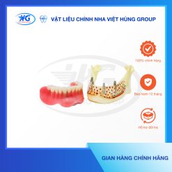 Mẫu Hàm Implant