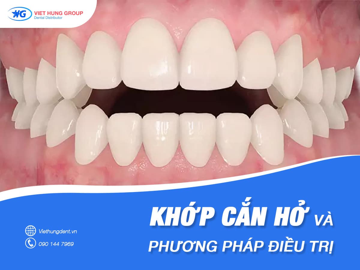 Khớp cắn hở và phương pháp điều trị