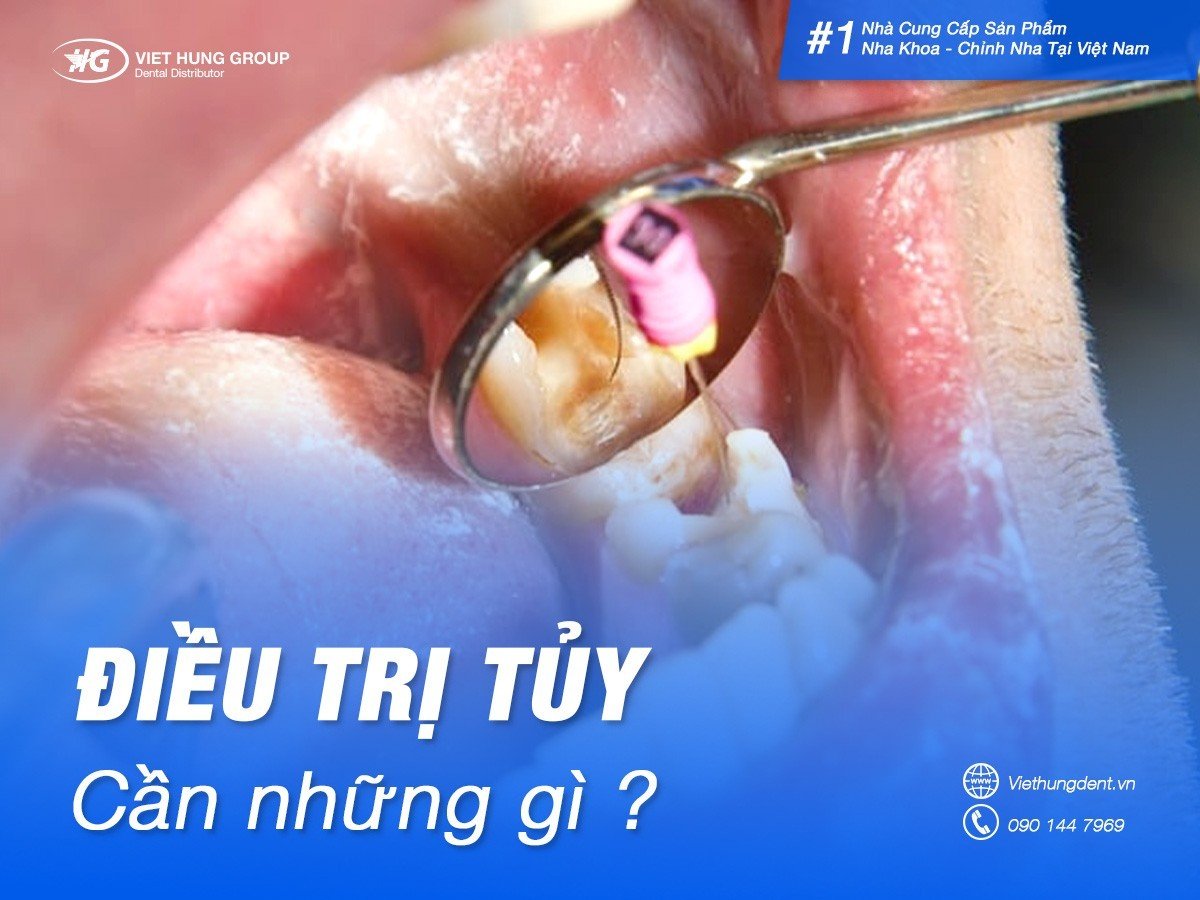 Điều trị tủy cần những gì