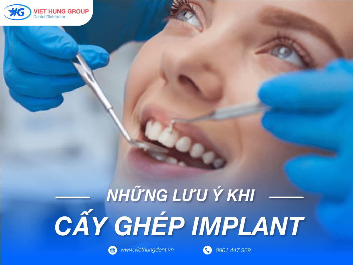 Những lưu ý khi cấy ghép imlant