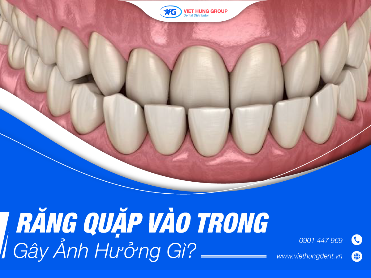 Răng-quặp-vào-trong-gây-ảnh-hưởng-gì