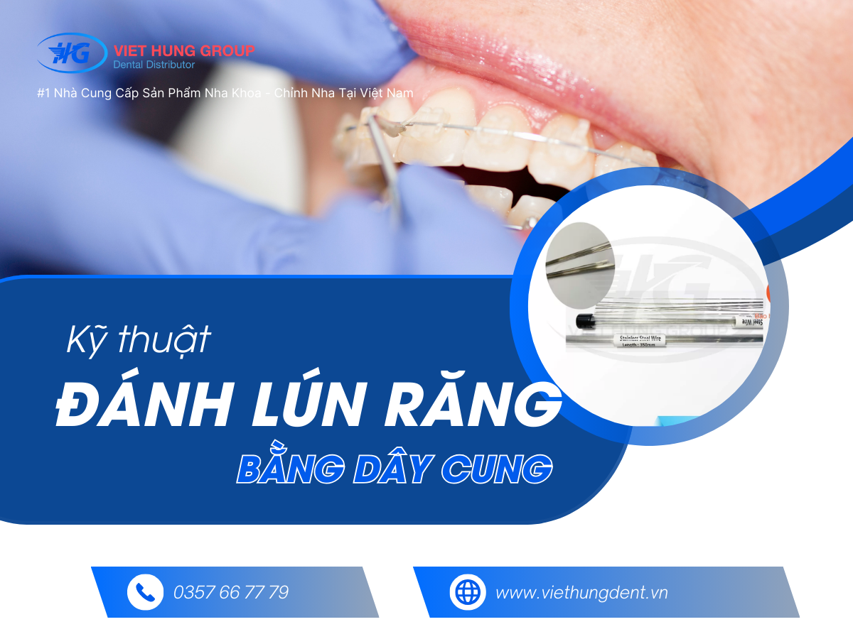 Kỹ thuật đánh lún răng bằng dây cung