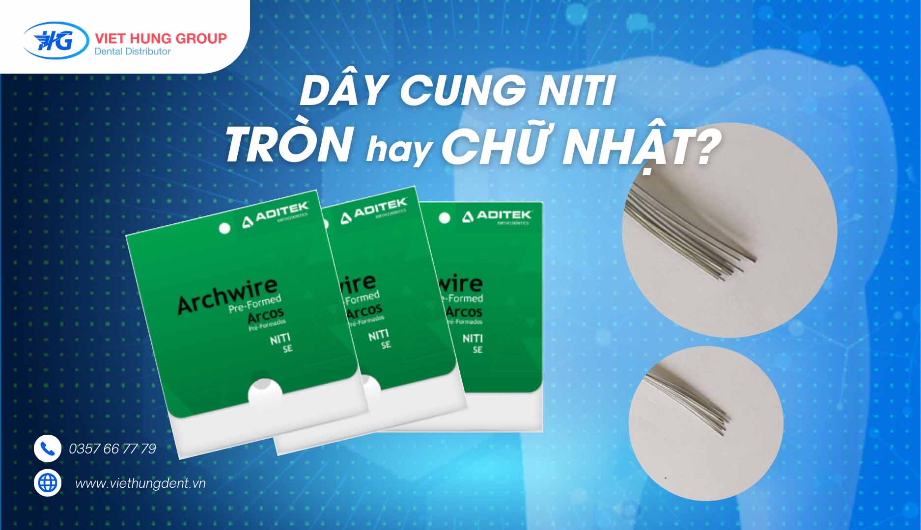 Dây cung chỉnh nha NiTi