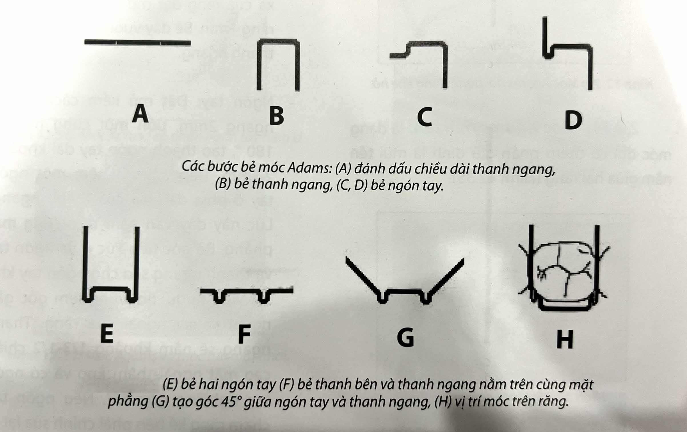 bẻ móc Adams bằng kềm chỉnh nha Adams